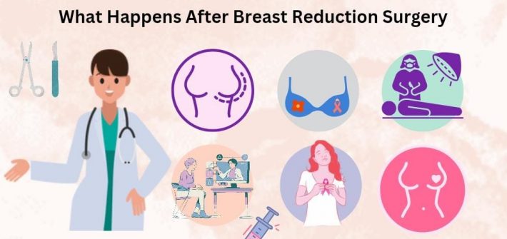 Breast Reduction Surgery