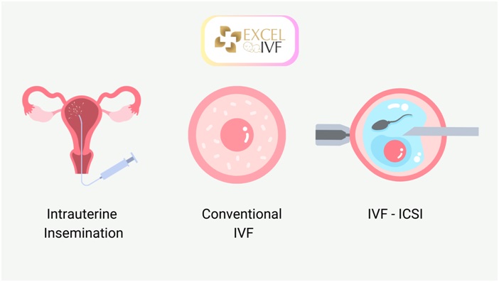 Female Infertility 4