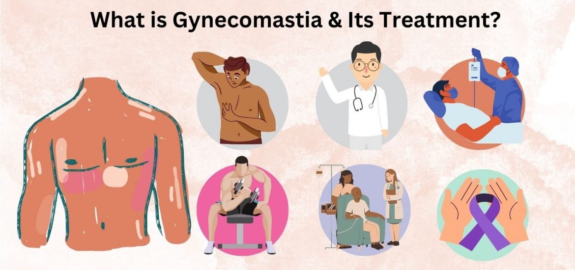 Gynecomastia