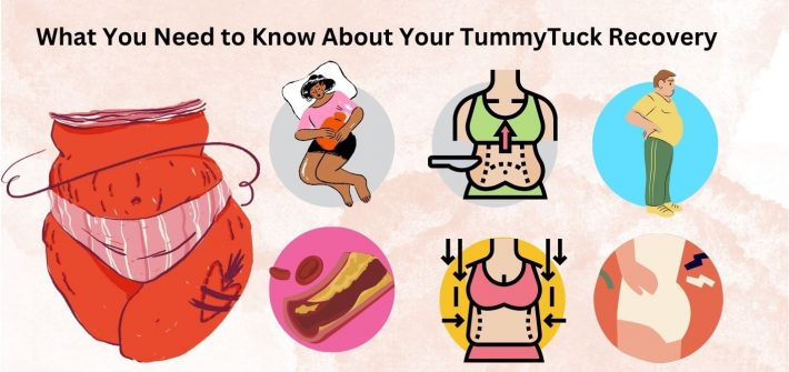 Tummy Tuck Recovery